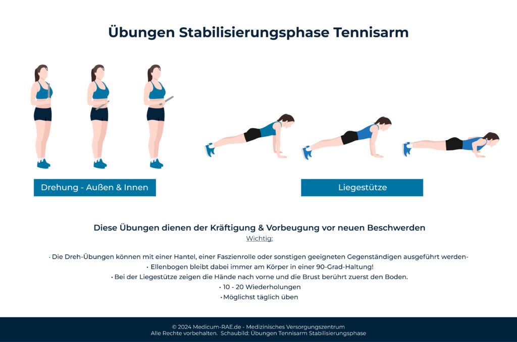 Das Bild zeigt Übungen bei Tennisarm in der Stabilisierungsphase.