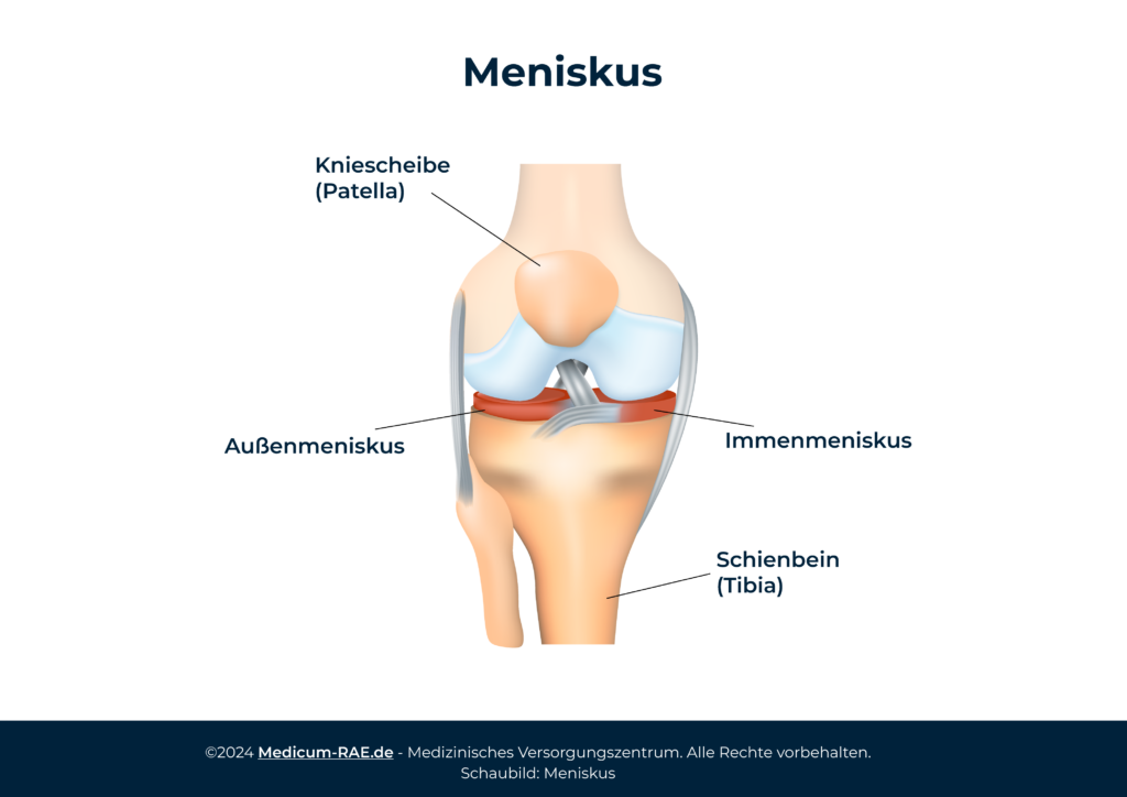 Schaubild: Meniskus